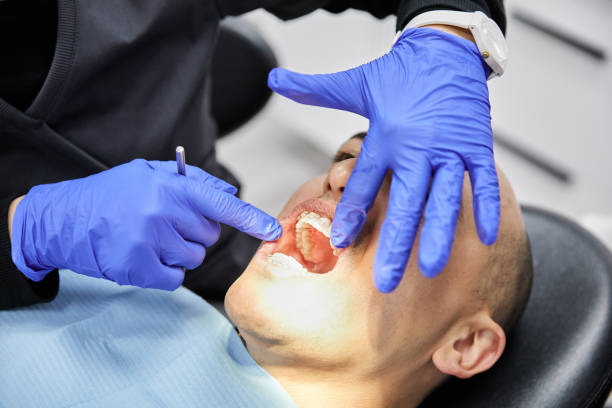 Best Emergency Dental Extractions in Mill Plain, CT